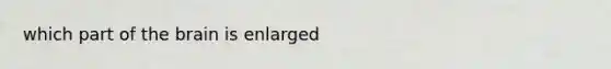 which part of the brain is enlarged