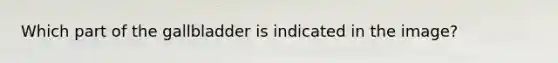 Which part of the gallbladder is indicated in the image?