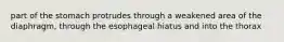 part of the stomach protrudes through a weakened area of the diaphragm, through the esophageal hiatus and into the thorax