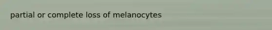 partial or complete loss of melanocytes