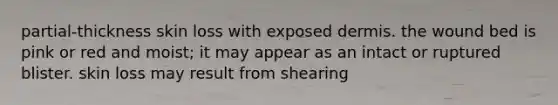 partial-thickness skin loss with exposed dermis. the wound bed is pink or red and moist; it may appear as an intact or ruptured blister. skin loss may result from shearing