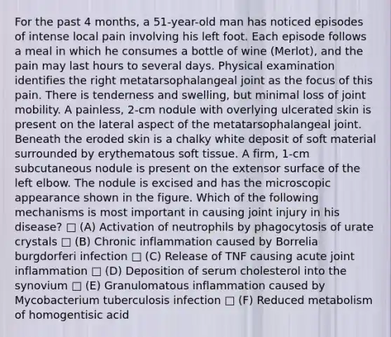 For the past 4 months, a 51-year-old man has noticed episodes of intense local pain involving his left foot. Each episode follows a meal in which he consumes a bottle of wine (Merlot), and the pain may last hours to several days. Physical examination identifies the right metatarsophalangeal joint as the focus of this pain. There is tenderness and swelling, but minimal loss of joint mobility. A painless, 2-cm nodule with overlying ulcerated skin is present on the lateral aspect of the metatarsophalangeal joint. Beneath the eroded skin is a chalky white deposit of soft material surrounded by erythematous soft tissue. A firm, 1-cm subcutaneous nodule is present on the extensor surface of the left elbow. The nodule is excised and has the microscopic appearance shown in the figure. Which of the following mechanisms is most important in causing joint injury in his disease? □ (A) Activation of neutrophils by phagocytosis of urate crystals □ (B) Chronic inflammation caused by Borrelia burgdorferi infection □ (C) Release of TNF causing acute joint inflammation □ (D) Deposition of serum cholesterol into the synovium □ (E) Granulomatous inflammation caused by Mycobacterium tuberculosis infection □ (F) Reduced metabolism of homogentisic acid