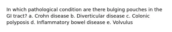 In which pathological condition are there bulging pouches in the GI tract? a. Crohn disease b. Diverticular disease c. Colonic polyposis d. Inflammatory bowel disease e. Volvulus