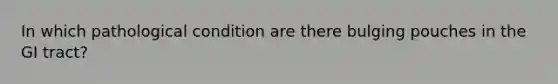 In which pathological condition are there bulging pouches in the GI tract?