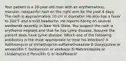 Your patient is a 20-year-old man with an erythematous, macular, nonpainful rash on the right arm for the past 4 days. The rash is approximately 10 cm in diameter. He also has a fever to 100°F and a mild headache. He reports hiking on several weekends recently in New York State. You suspect the rash is erythema migrans and that he has Lyme disease. Assume the patient does have Lyme disease. Which one of the following antibiotics is the most appropriate to treat his infection? A Azithromycin or trimethoprim-sulfamethoxazole B Doxycycline or amoxicillin C Gentamicin or amikacin D Metronidazole or clindamycin E Penicillin G or levofloxacin