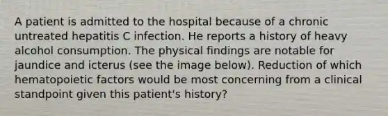 A patient is admitted to the hospital because of a chronic untreated hepatitis C infection. He reports a history of heavy alcohol consumption. The physical findings are notable for jaundice and icterus (see the image below). Reduction of which hematopoietic factors would be most concerning from a clinical standpoint given this patient's history?