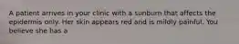 A patient arrives in your clinic with a sunburn that affects the epidermis only. Her skin appears red and is mildly painful. You believe she has a