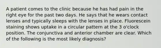 A patient comes to the clinic because he has had pain in the right eye for the past two days. He says that he wears contact lenses and typically sleeps with the lenses in place. Fluorescein staining shows uptake in a circular pattern at the 3 o'clock position. The conjunctiva and anterior chamber are clear. Which of the following is the most likely diagnosis?