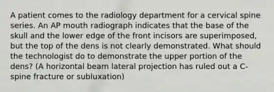 A patient comes to the radiology department for a cervical spine series. An AP mouth radiograph indicates that the base of the skull and the lower edge of the front incisors are superimposed, but the top of the dens is not clearly demonstrated. What should the technologist do to demonstrate the upper portion of the dens? (A horizontal beam lateral projection has ruled out a C-spine fracture or subluxation)