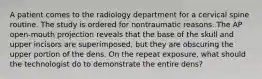 A patient comes to the radiology department for a cervical spine routine. The study is ordered for nontraumatic reasons. The AP open-mouth projection reveals that the base of the skull and upper incisors are superimposed, but they are obscuring the upper portion of the dens. On the repeat exposure, what should the technologist do to demonstrate the entire dens?