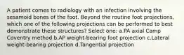 A patient comes to radiology with an infection involving the sesamoid bones of the foot. Beyond the routine foot projections, which one of the following projections can be performed to best demonstrate these structures? Select one: a.PA axial Camp Coventry method b.AP weight-bearing foot projection c.Lateral weight-bearing projection d.Tangential projection