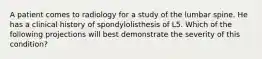 A patient comes to radiology for a study of the lumbar spine. He has a clinical history of spondylolisthesis of L5. Which of the following projections will best demonstrate the severity of this condition?