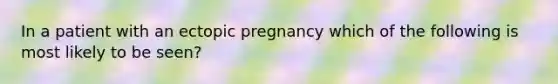 In a patient with an ectopic pregnancy which of the following is most likely to be seen?