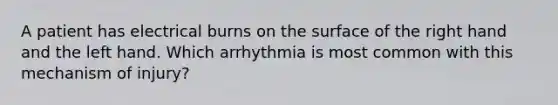 A patient has electrical burns on the surface of the right hand and the left hand. Which arrhythmia is most common with this mechanism of injury?