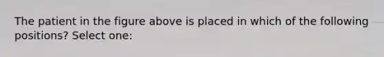 The patient in the figure above is placed in which of the following positions? Select one: