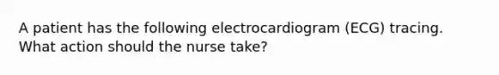 A patient has the following electrocardiogram (ECG) tracing. What action should the nurse take?