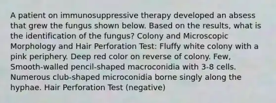 A patient on immunosuppressive therapy developed an absess that grew the fungus shown below. Based on the results, what is the identification of the fungus? Colony and Microscopic Morphology and Hair Perforation Test: Fluffy white colony with a pink periphery. Deep red color on reverse of colony. Few, Smooth-walled pencil-shaped macroconidia with 3-8 cells. Numerous club-shaped microconidia borne singly along the hyphae. Hair Perforation Test (negative)