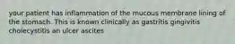 your patient has inflammation of the mucous membrane lining of the stomach. This is known clinically as gastritis gingivitis cholecystitis an ulcer ascites