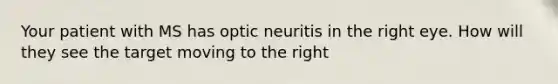 Your patient with MS has optic neuritis in the right eye. How will they see the target moving to the right