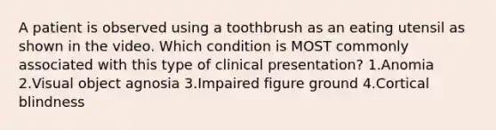 A patient is observed using a toothbrush as an eating utensil as shown in the video. Which condition is MOST commonly associated with this type of clinical presentation? 1.Anomia 2.Visual object agnosia 3.Impaired figure ground 4.Cortical blindness