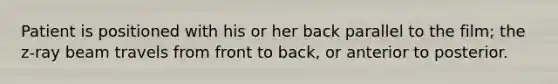 Patient is positioned with his or her back parallel to the film; the z-ray beam travels from front to back, or anterior to posterior.