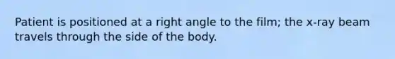 Patient is positioned at a <a href='https://www.questionai.com/knowledge/kIh722csLJ-right-angle' class='anchor-knowledge'>right angle</a> to the film; the x-ray beam travels through the side of the body.