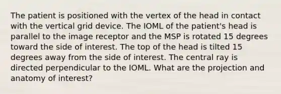 The patient is positioned with the vertex of the head in contact with the vertical grid device. The IOML of the patient's head is parallel to the image receptor and the MSP is rotated 15 degrees toward the side of interest. The top of the head is tilted 15 degrees away from the side of interest. The central ray is directed perpendicular to the IOML. What are the projection and anatomy of interest?
