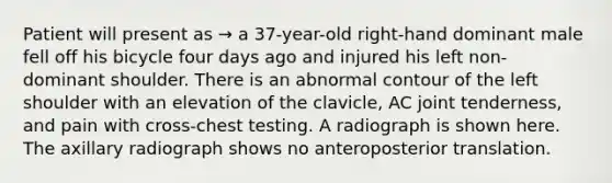 Patient will present as → a 37-year-old right-hand dominant male fell off his bicycle four days ago and injured his left non-dominant shoulder. There is an abnormal contour of the left shoulder with an elevation of the clavicle, AC joint tenderness, and pain with cross-chest testing. A radiograph is shown here. The axillary radiograph shows no anteroposterior translation.
