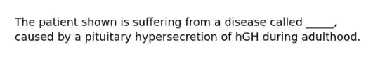 The patient shown is suffering from a disease called _____, caused by a pituitary hypersecretion of hGH during adulthood.