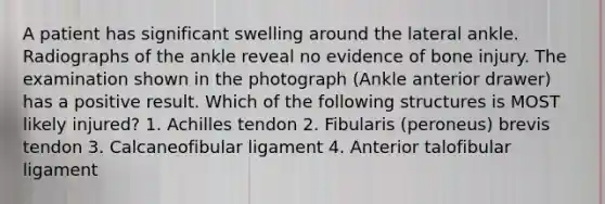 A patient has significant swelling around the lateral ankle. Radiographs of the ankle reveal no evidence of bone injury. The examination shown in the photograph (Ankle anterior drawer) has a positive result. Which of the following structures is MOST likely injured? 1. Achilles tendon 2. Fibularis (peroneus) brevis tendon 3. Calcaneofibular ligament 4. Anterior talofibular ligament