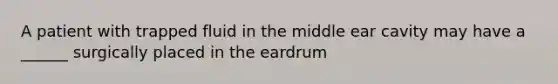 A patient with trapped fluid in the middle ear cavity may have a ______ surgically placed in the eardrum