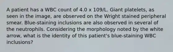 A patient has a WBC count of 4.0 x 109/L. Giant platelets, as seen in the image, are observed on the Wright stained peripheral smear. Blue-staining inclusions are also observed in several of the neutrophils. Considering the morphology noted by the white arrow, what is the identity of this patient's blue-staining WBC inclusions?