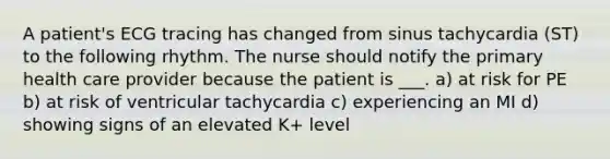 A patient's ECG tracing has changed from sinus tachycardia (ST) to the following rhythm. The nurse should notify the primary health care provider because the patient is ___. a) at risk for PE b) at risk of ventricular tachycardia c) experiencing an MI d) showing signs of an elevated K+ level