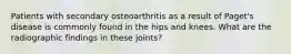 Patients with secondary osteoarthritis as a result of Paget's disease is commonly found in the hips and knees. What are the radiographic findings in these joints?