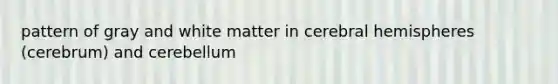 pattern of gray and white matter in cerebral hemispheres (cerebrum) and cerebellum