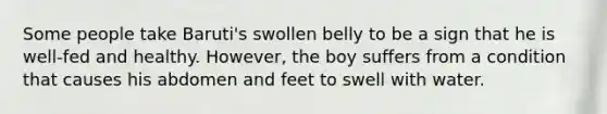 Some people take Baruti's swollen belly to be a sign that he is well-fed and healthy. However, the boy suffers from a condition that causes his abdomen and feet to swell with water.