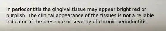 In periodontitis the gingival tissue may appear bright red or purplish. The clinical appearance of the tissues is not a reliable indicator of the presence or severity of chronic periodontitis