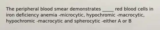 The peripheral blood smear demonstrates _____ red blood cells in iron deficiency anemia -microcytic, hypochromic -macrocytic, hypochromic -macrocytic and spherocytic -either A or B