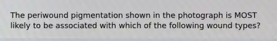 The periwound pigmentation shown in the photograph is MOST likely to be associated with which of the following wound types?