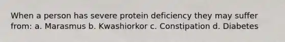 When a person has severe protein deficiency they may suffer from: a. Marasmus b. Kwashiorkor c. Constipation d. Diabetes