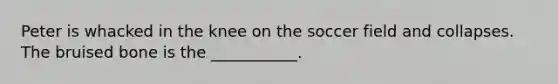 Peter is whacked in the knee on the soccer field and collapses. The bruised bone is the ___________.