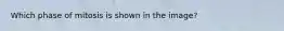 Which phase of mitosis is shown in the image?