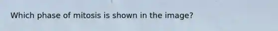 Which phase of mitosis is shown in the image?