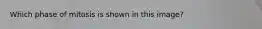 Which phase of mitosis is shown in this image?