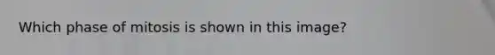 Which phase of mitosis is shown in this image?
