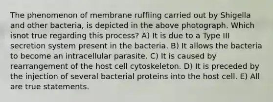 The phenomenon of membrane ruffling carried out by Shigella and other bacteria, is depicted in the above photograph. Which isnot true regarding this process? A) It is due to a Type III secretion system present in the bacteria. B) It allows the bacteria to become an intracellular parasite. C) It is caused by rearrangement of the host cell cytoskeleton. D) It is preceded by the injection of several bacterial proteins into the host cell. E) All are true statements.