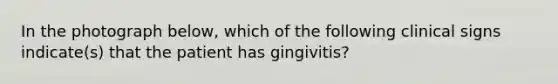 In the photograph below, which of the following clinical signs indicate(s) that the patient has gingivitis?