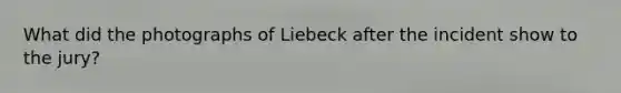 What did the photographs of Liebeck after the incident show to the jury?