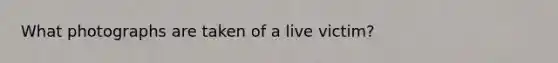 What photographs are taken of a live victim?