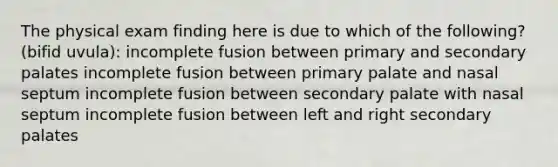 The physical exam finding here is due to which of the following? (bifid uvula): incomplete fusion between primary and secondary palates incomplete fusion between primary palate and nasal septum incomplete fusion between secondary palate with nasal septum incomplete fusion between left and right secondary palates